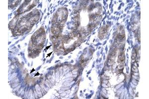 EAP30 antibody was used for immunohistochemistry at a concentration of 4-8 ug/ml to stain EpitheliaI Cells of Fundic Gland (arrows) and Surface Mucous Cells (Indicated with Arrow Heads) in Human Stomach.