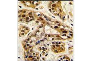 Image no. 1 for anti-Protein Arginine Methyltransferase 1 (PRMT1) (C-Term) antibody (ABIN356520) (PRMT1 antibody  (C-Term))