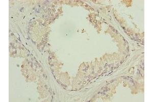 Immunohistochemistry (IHC) image for anti-Protein Tyrosine Phosphatase-Like (Proline Instead of Catalytic Arginine), Member B (PTPLB) (AA 7-41) antibody (ABIN7175441)