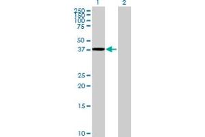 Western Blot analysis of TTLL1 expression in transfected 293T cell line by TTLL1 MaxPab polyclonal antibody. (TTLL1 antibody  (AA 1-423))