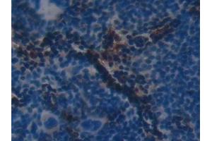Immunohistochemistry (IHC) image for anti-Complement Factor H (CFH) (AA 915-1156) antibody (ABIN7432277)