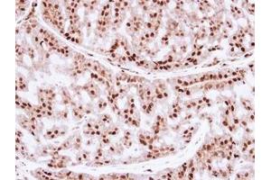 Image no. 1 for anti-Zinc Finger and SCAN Domain Containing 31 (ZSCAN31) (AA 66-379) antibody (ABIN1501836) (Zinc Finger and SCAN Domain Containing 31 (ZSCAN31) (AA 66-379) antibody)