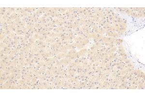 Detection of a2PI in Human Liver Tissue using Polyclonal Antibody to Alpha 2-Antiplasmin (a2PI) (alpha 2 Antiplasmin antibody)