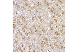 Immunohistochemistry of paraffin-embedded rat brain using IRS1 Rabbit pAb (ABIN3020773, ABIN3020774, ABIN3020775, ABIN1513104 and ABIN6213716) at dilution of 1:150 (40x lens). (IRS1 antibody)