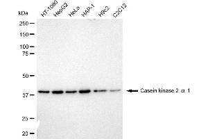 Western blotting analysis using Casein kinase 2 alpha 1 antibody (ABIN7797882).