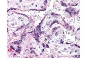Immunohistochemistry of Rabbit anti-EGFR pY1197 antibody. (EGFR antibody  (AA 1175-1200))