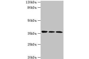 Western blot All lanes: SLAMF7 antibody at 3 μg/mL Lane 1: Jurkat whole cell lysate Lane 2: K562 whole cell lysate Lane 3: Mouse spleen tissue Secondary Goat polyclonal to rabbit IgG at 1/10000 dilution Predicted band size: 38, 26, 18, 33, 23, 22 kDa Observed band size: 38 kDa (SLAMF7 antibody  (AA 23-226))