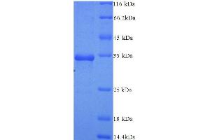 SDS-PAGE (SDS) image for Argonaute 2 (AGO2) (AA 517-818) protein (His tag) (ABIN5714512) (AGO2 Protein (AA 517-818) (His tag))