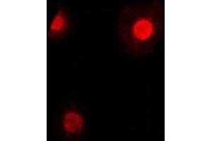 Immunofluorescent analysis of TEAD2 staining in HepG2 cells. (TEAD2 antibody)