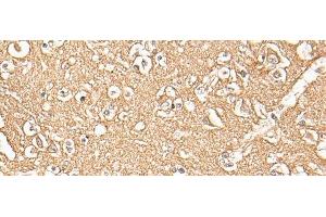 Immunohistochemistry of paraffin-embedded Human brain tissue using ADORA3 Polyclonal Antibody at dilution of 1:30(x200) (Adenosine A3 Receptor antibody)