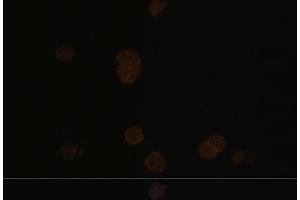 Immunofluorescence analysis of Y79 cells using RCVRN Polyclonal Antibody at dilution of 1:100. (Recoverin antibody)