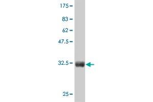 Western Blot detection against Immunogen (36. (CTNNB1 antibody  (AA 682-781))