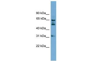 WB Suggested Anti-WDR16 Antibody Titration: 0. (WDR16 antibody  (Middle Region))