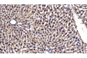 Detection of TXNRD1 in Mouse Liver Tissue using Polyclonal Antibody to Thioredoxin Reductase 1 (TXNRD1) (TXNRD1 antibody  (AA 374-577))