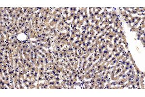 Detection of TXNRD1 in Mouse Liver Tissue using Polyclonal Antibody to Thioredoxin Reductase 1 (TXNRD1)