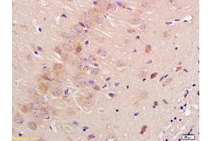 Formalin-fixed and paraffin embedded rat brain labeled with Anti-Contactin 3 Polyclonal Antibody, Unconjugated (ABIN761441) at 1:200 followed by conjugation to the secondary antibody and DAB staining (CNTN3 antibody  (AA 301-400))