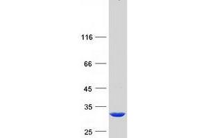 Validation with Western Blot