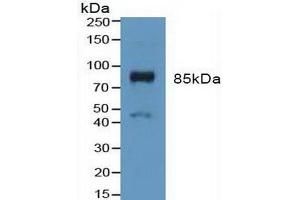 Detection of FGFR3 in Mouse Placenta Tissue using Polyclonal Antibody to Fibroblast Growth Factor Receptor 3 (FGFR3) (FGFR3 antibody  (AA 166-375))