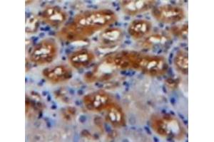 Used in DAB staining on fromalin fixed paraffin-embedded Kidney tissue (PDGF-AA Homodimer (AA 87-211) antibody)