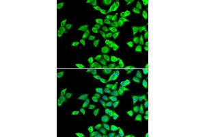Immunofluorescence analysis of U2OS cells using NMT2 antibody (ABIN5974237). (NMT2 antibody)
