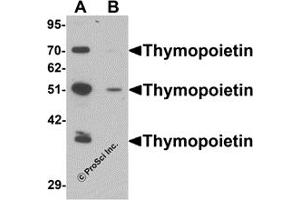 Western Blotting (WB) image for anti-Thymopoietin (TMPO) (N-Term) antibody (ABIN1031615) (Thymopoietin antibody  (N-Term))