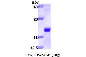 SDS-PAGE (SDS) image for Apolipoprotein M (APOM) (AA 23-188) protein (His tag) (ABIN667777) (Apolipoprotein M Protein (APOM) (AA 23-188) (His tag))