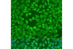 Immunofluorescence analysis of U2OS cells using EIF3A Polyclonal Antibody at dilution of 1:100. (EIF3A antibody)
