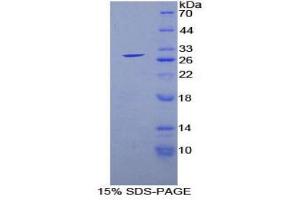 SDS-PAGE (SDS) image for Glutathione S-Transferase alpha 1 (GSTA1) (AA 2-222) protein (His tag) (ABIN1079678)