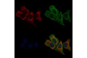 ABIN6264832 and ABIN6279043 staining Hela cells by IF/ICC.