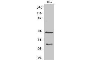 Western Blotting (WB) image for anti-Cathepsin D (CTSD) (Internal Region) antibody (ABIN3174201) (Cathepsin D antibody  (Internal Region))
