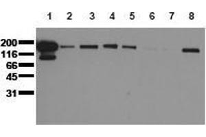 Western Blotting (WB) image for anti-Epidermal Growth Factor Receptor (EGFR) (N-Term) antibody (ABIN126782) (EGFR antibody  (N-Term))