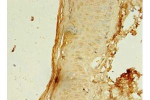 Immunohistochemistry of paraffin-embedded human skin tissue using ABIN7148112 at dilution of 1:100