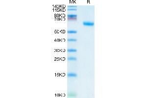 TNFRSF1A Protein (AA 30-211) (Fc Tag)