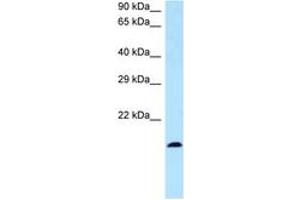 Image no. 1 for anti-Bone Marrow Stromal Cell Antigen 2 (BST2) (N-Term) antibody (ABIN6747353) (BST2 antibody  (N-Term))
