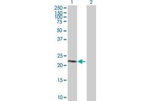 Western Blot analysis of SIRPD expression in transfected 293T cell line by SIRPD MaxPab polyclonal antibody. (SIRPD antibody  (AA 1-197))