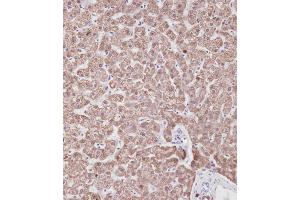 Immunohistochemical analysis of A on paraffin-embedded Human liver tissue. (Prohibitin antibody  (N-Term))