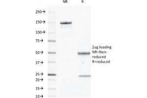 SDS-PAGE Analysis Purified CD40 Mouse Monoclonal Antibody (C40/2383). (CD40 antibody  (AA 29-107))