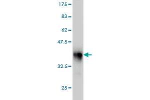 Western Blot detection against Immunogen (34. (LASS4 antibody  (AA 57-139))
