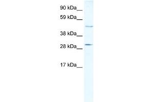 WB Suggested Anti-CASP3 Antibody Titration:  5ug/ml  Positive Control:  Human Liver (Caspase 3 antibody  (N-Term))