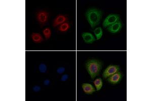 ABIN6262848 and ABIN6276891 staining Hela cells by IF/ICC. (Kallikrein 1 antibody  (Internal Region))
