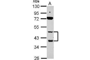 WB Image Sample (30 ug of whole cell lysate) A: HepG2 10% SDS PAGE antibody diluted at 1:1000 (Retinoic Acid Receptor beta antibody)