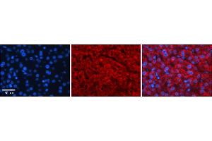 Rabbit Anti-GAMT Antibody    Formalin Fixed Paraffin Embedded Tissue: Human Adult liver  Observed Staining: Cytoplasmic Primary Antibody Concentration: 1:100 Secondary Antibody: Donkey anti-Rabbit-Cy2/3 Secondary Antibody Concentration: 1:200 Magnification: 20X Exposure Time: 0. (GAMT antibody  (Middle Region))
