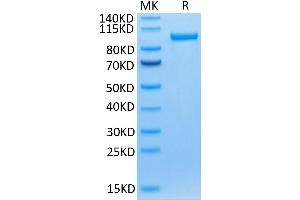 Human Transferrin R on Tris-Bis PAGE under reduced condition. (Transferrin Receptor Protein (AA 89-760) (Fc Tag))