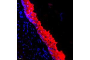 Immunofluorescence of paraffin embedded rat esophagus using CK13 (ABIN7074411) at dilution of 1:500 (400x lens) (Cytokeratin 13 antibody  (C-Term))
