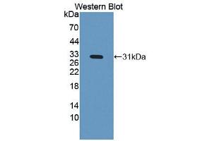 Western blot analysis of the recombinant protein. (IGFBP4 antibody  (AA 22-258))