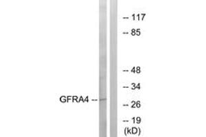 Western blot analysis of extracts from HeLa cells, using GFRA4 Antibody. (GFRA4 antibody  (AA 141-190))