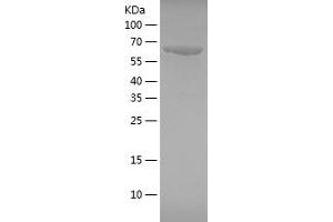 Western Blotting (WB) image for Heat Shock 70kDa Protein 1A (HSPA1A) (AA 291-641) protein (His-IF2DI Tag) (ABIN7123270) (HSP70 1A Protein (AA 291-641) (His-IF2DI Tag))