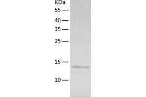 Western Blotting (WB) image for Zinc Finger Protein 697 (ZNF697) (AA 1-136) protein (His tag) (ABIN7125798) (ZNF697 Protein (AA 1-136) (His tag))