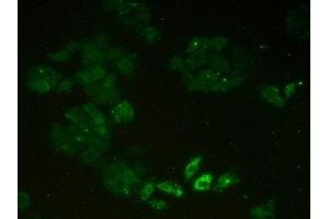 Detection of MCM2 in Human Hela Cells using Polyclonal Antibody to Minichromosome Maintenance Deficient 2 (MCM2) (MCM2 antibody  (AA 473-679))