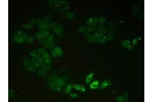 Detection of MCM2 in Human Hela Cells using Polyclonal Antibody to Minichromosome Maintenance Deficient 2 (MCM2) (Minichromosome Maintenance Deficient 2 (AA 473-679) antibody)